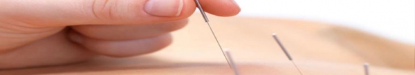 Acupuncture